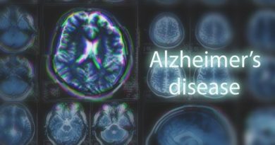 alzheimer's disease