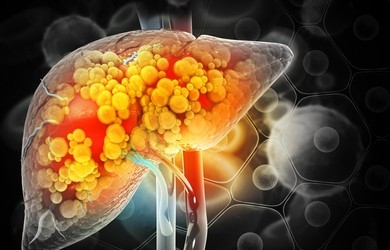 liver cancer survival rates